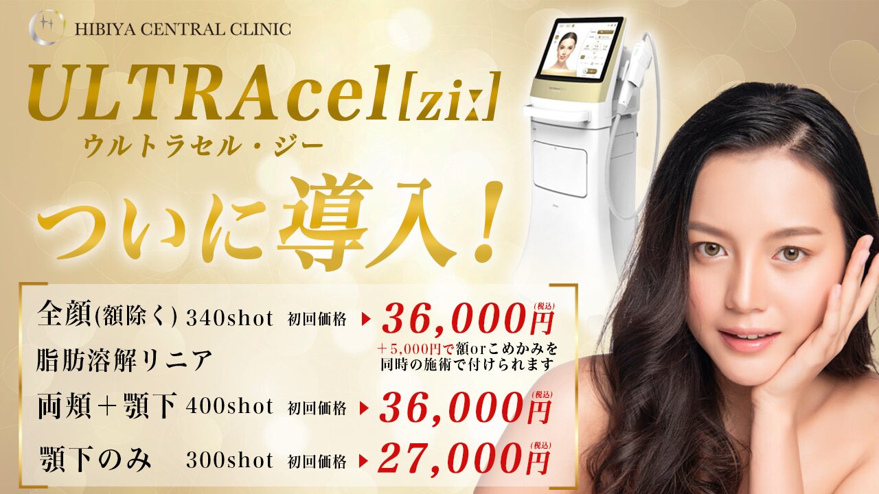 ULTRAcel[zi;]